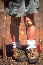 Little Boys Knees � Layne Kennedy